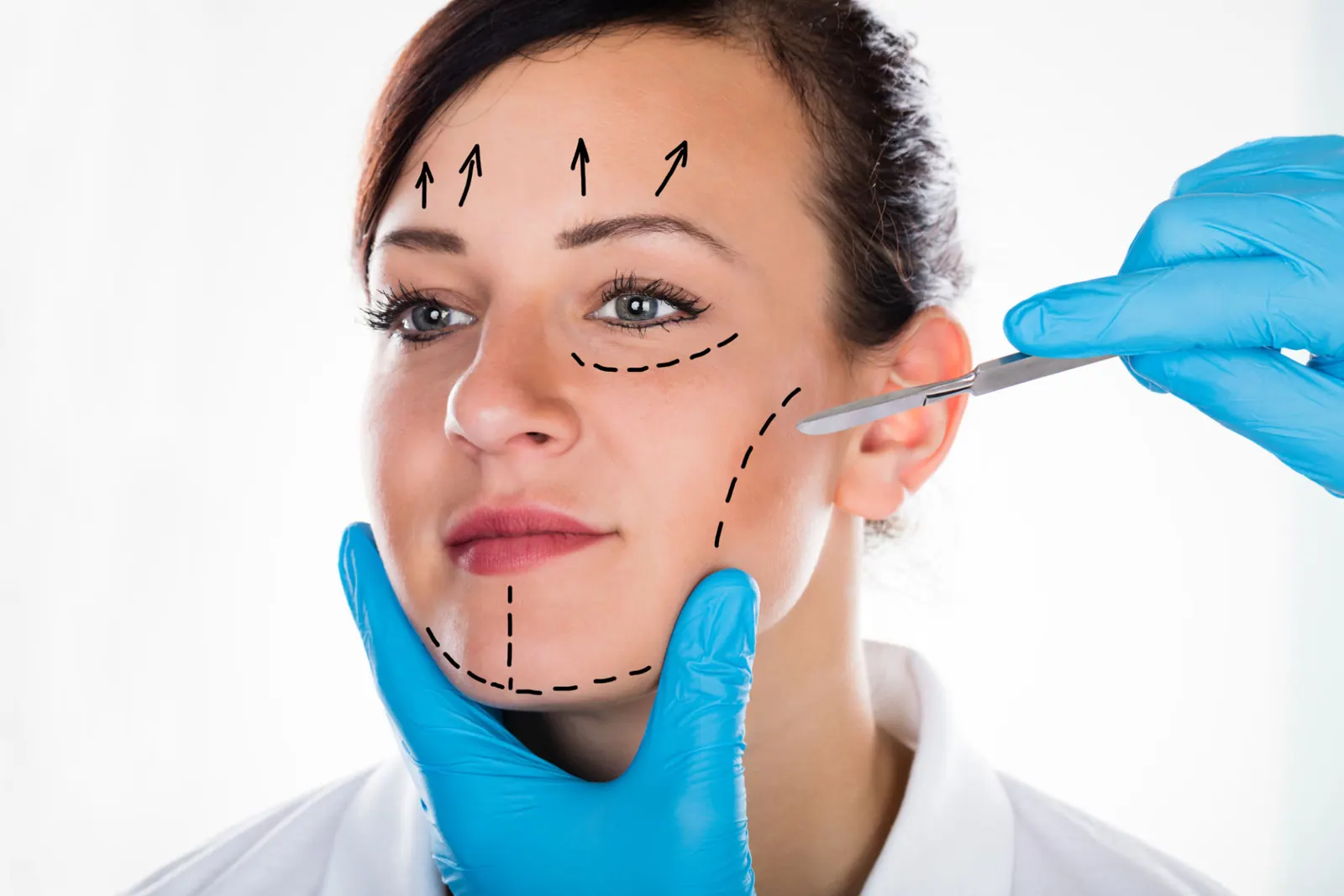 Rhinoplasty