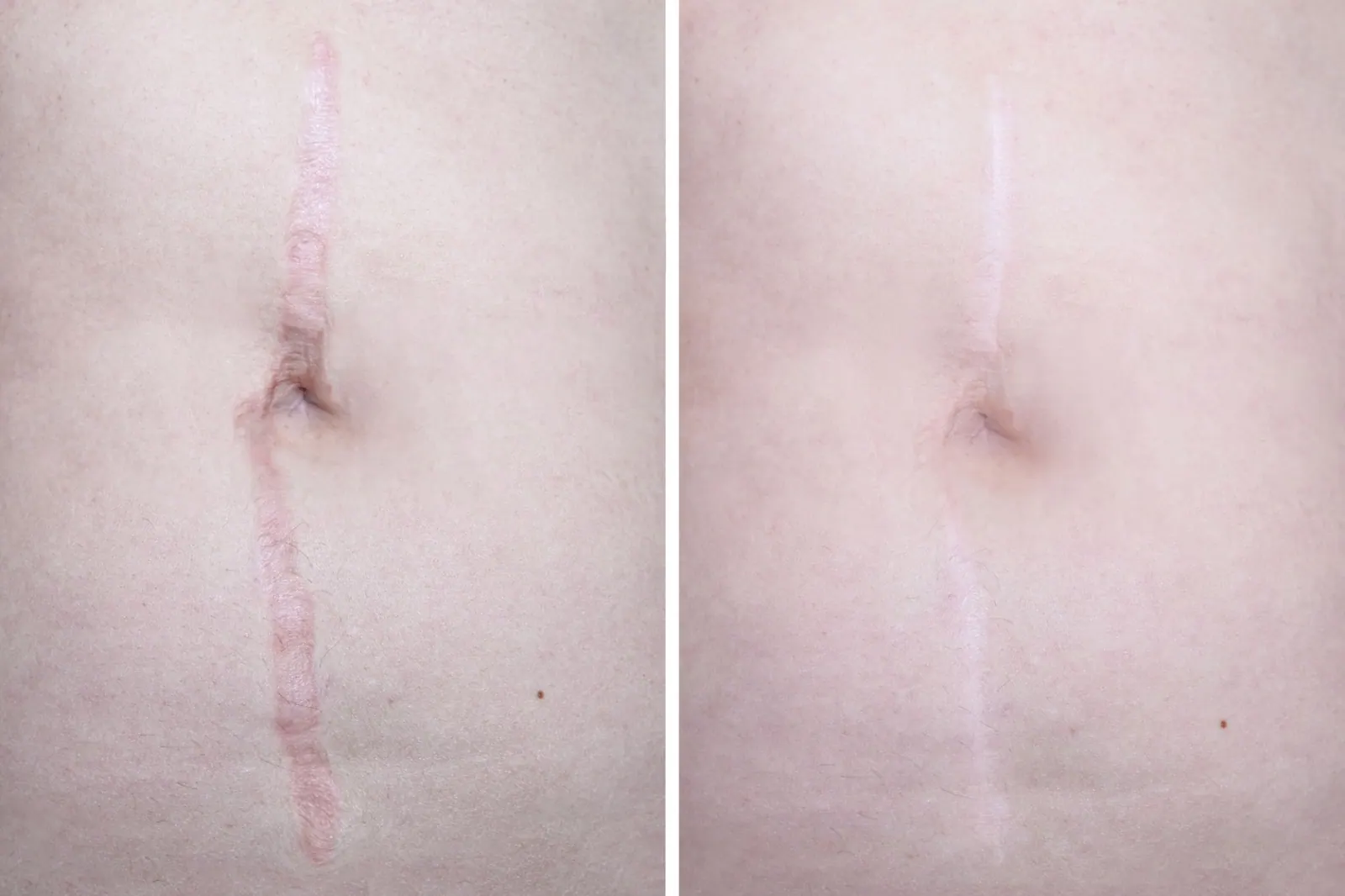 Before and after reconstructive surgery results